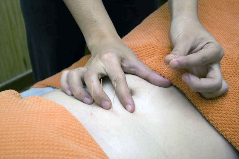 osteopathe-COTIGNAC-min_acupuncture-4175625